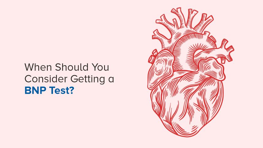 When Should You Consider Getting a BNP Test?